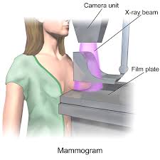 Experts Panel Insist that Mammograms are Going to be Worth It for Women 50-69