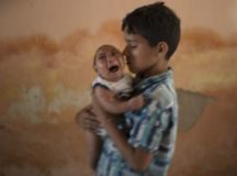 Microcephaly Linked To Zika Virus, Study Confirms Again