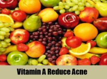 Relieve Acne With Vitamin A